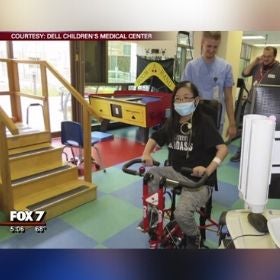 12-year-old patient receives life-saving mechanical heart pump at Dell Children’s