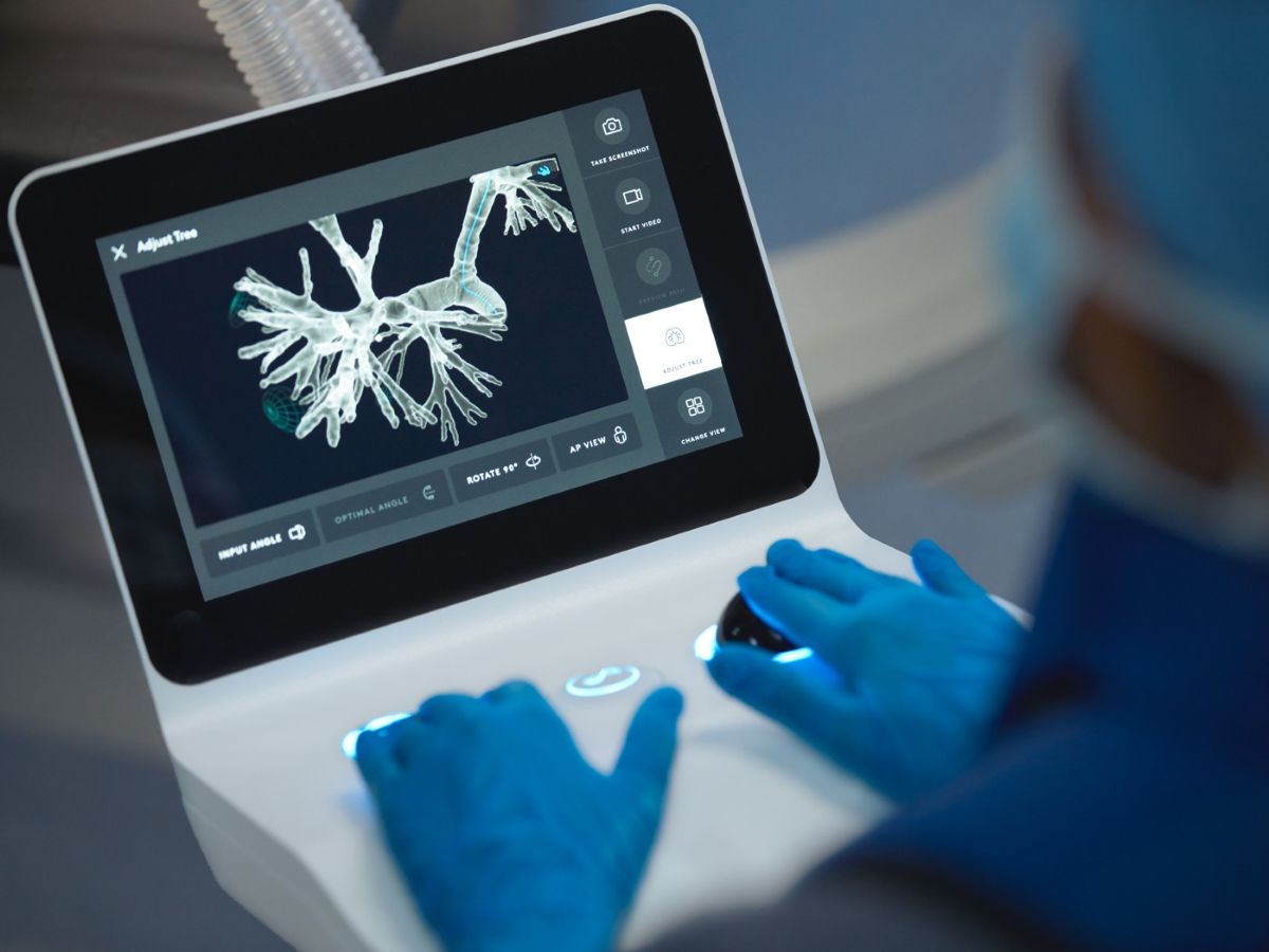 Via Christi Completes 1,000th Robotic-Assisted Procedure for Early Diagnosis of Lung Cancer