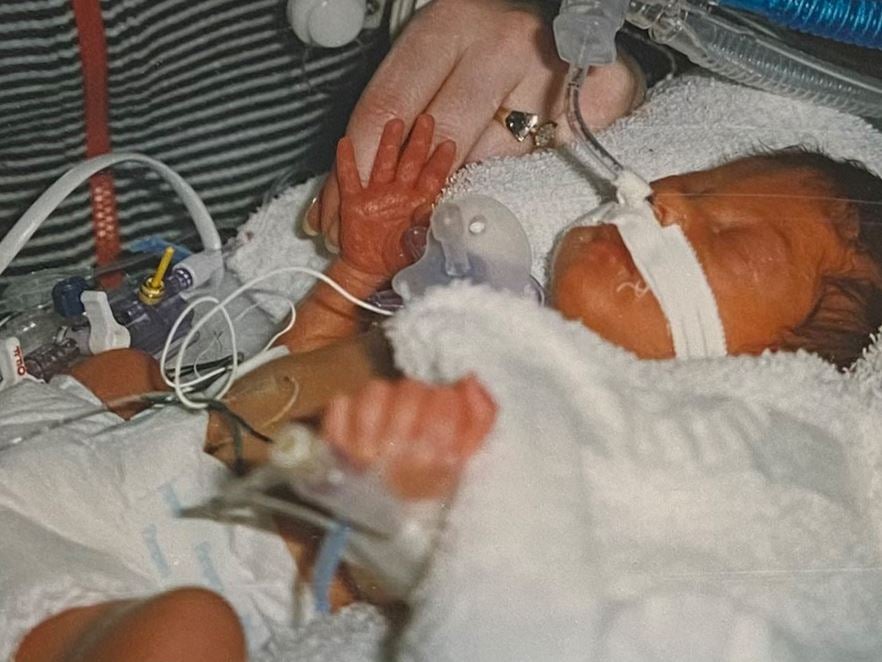 Premature newborn Hana Scott at 28 weeks, receiving care in a neonatal intensive care unit at Ascension Columbia St. Mary’s Milwaukee, with medical tubes and monitoring equipment visible as a caregiver gently holds her hand.