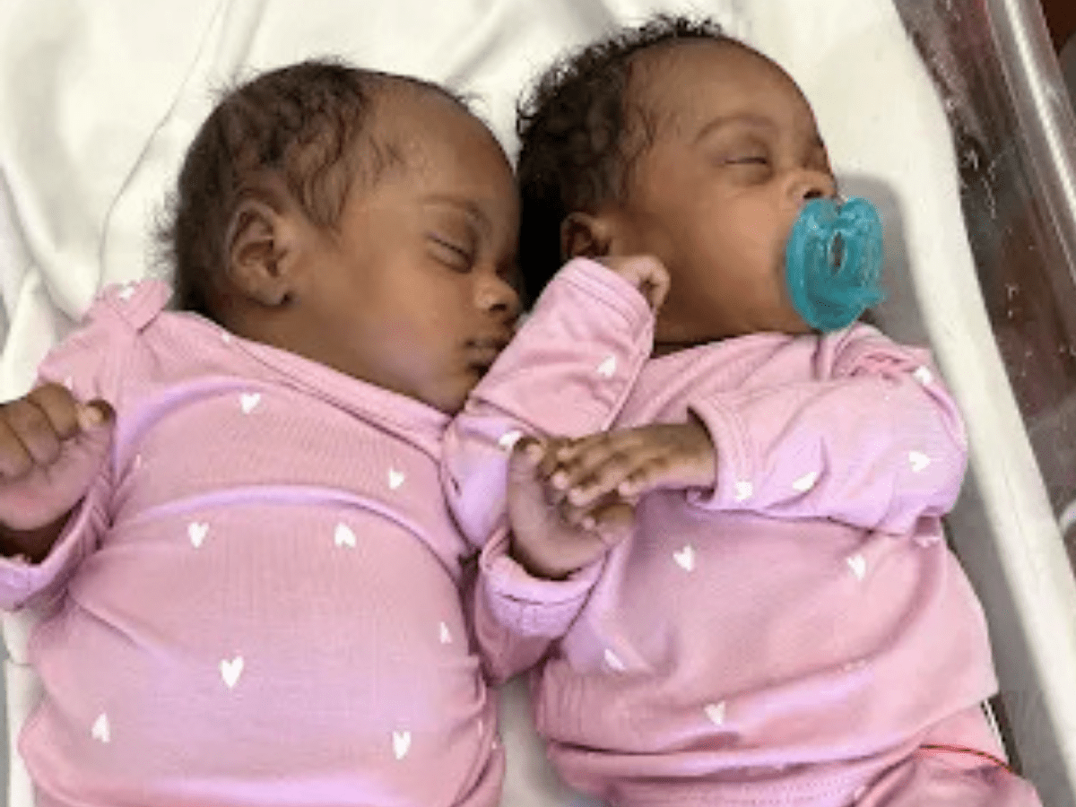 Ascension Columbia St. Mary's Milwaukee sees uptick in multiple births